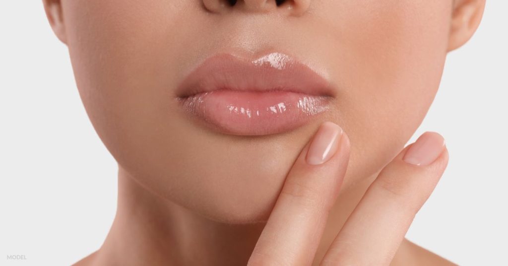 Glossy lips with mild swelling after lip filler (MODEL)